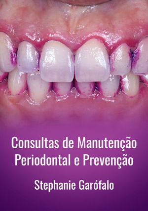 Consultas de Manutenção Periodontal e Prevenção