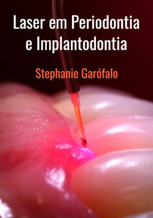 Laser em Periodontia e Implantodontia