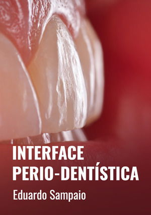 Interface Perio-Dentística