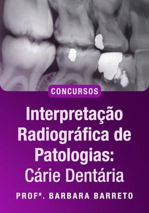 Interpretação Radiográfica de Patologias: Cárie Dentária para concursos