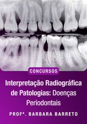 Interpretação Radiográfica de Patologias: Doenças Periodontais para concursos