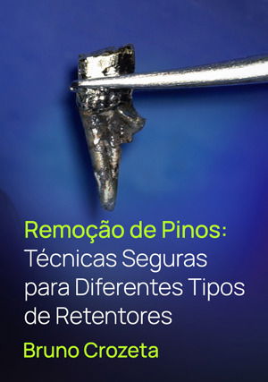 Remoção de Pinos: Técnicas Seguras para Diferentes Tipos de Retentores