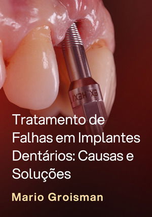 Tratamento de Falhas em Implantes Dentários: Causas e Soluções