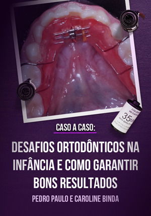 Caso a Caso - Desafios Ortodônticos na Infância e Como Garantir Bons Resultados