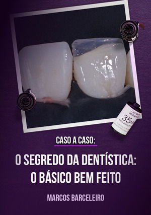 Ao Vivo: Caso a Caso - O Segredo da Dentística: O Básico Bem Feito