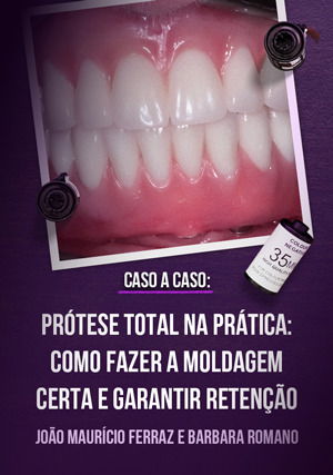Prótese Total na Prática: Como Fazer a Moldagem Certa e Garantir Retenção