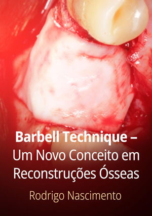 Barbell Technique – Um Novo Conceito em Reconstruções Ósseas