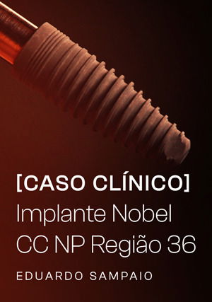 Caso Clínico: Implante Nobel CC NP região 36