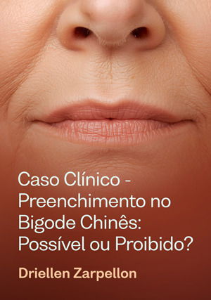 Caso Clínico - Preenchimento no Bigode Chinês: possível ou proibido?