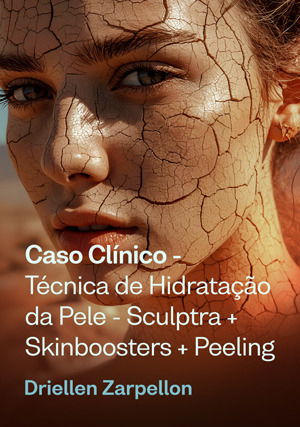 Caso Clínico: ⁠Técnica de Hidratação da Pele - Sculptra + Skinboosters + Peeling