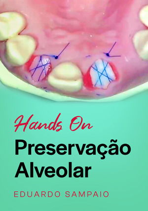Hands on: Preservação Alveolar