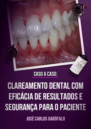 Caso a Caso: Clareamento Dental com Eficácia de Resultados e Segurança para o Paciente