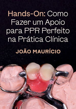 Hands-on: Como Fazer um Apoio para PPR Perfeito na Prática Clínica