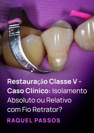 Restauração Classe V - Caso Clínico: Isolamento Absoluto ou Relativo com fio retrator?
