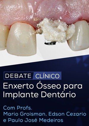 Debate Clínico: Enxerto Ósseo para Implante Dentário